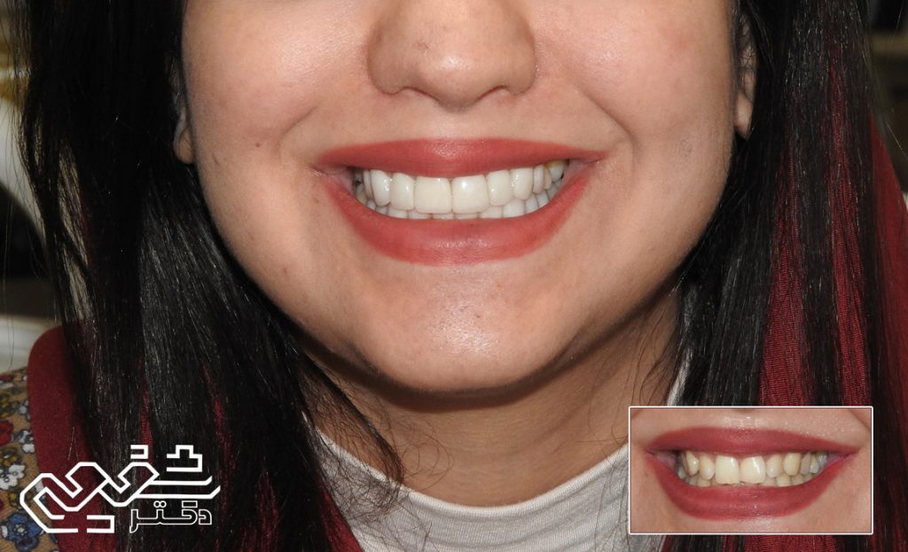 دندانپزشکی زیبایی