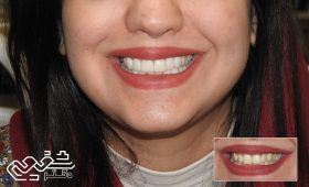 دندانپزشکی زیبایی