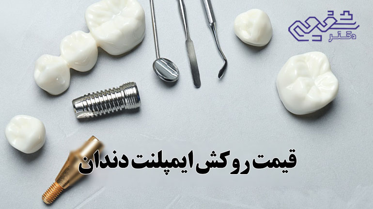 قیمت روکش ایمپلنت
