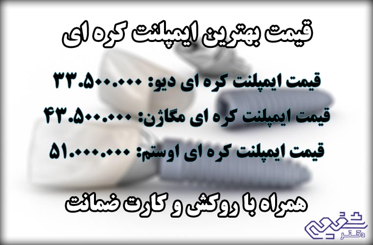قیمت بهترین ایمپلنت کره ای